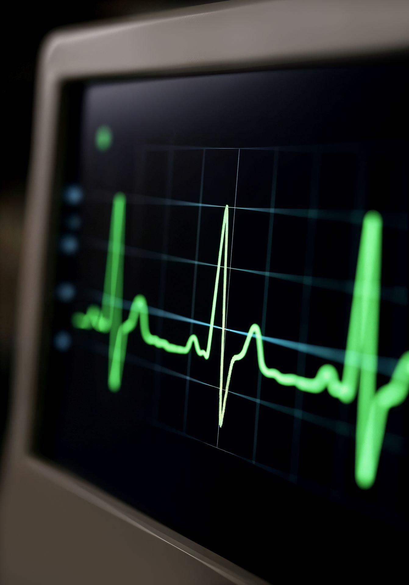 ECG monitor illustrating heart-rhythm diagnostics